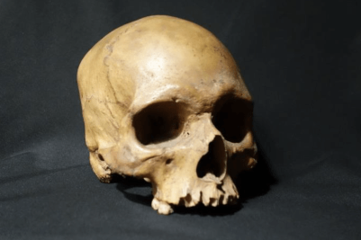 Ancient Micronesian skull