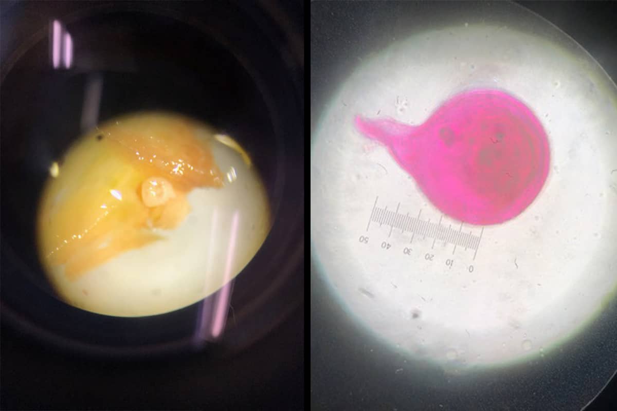 Microscope images of a nematode